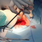 應該如何面對「發作」密集期間? 3 hospital 721241 960 720