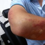 injury 199025 960 720