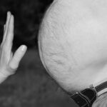 關節炎診斷:症狀和測試 1 obesity 3247168 960 720