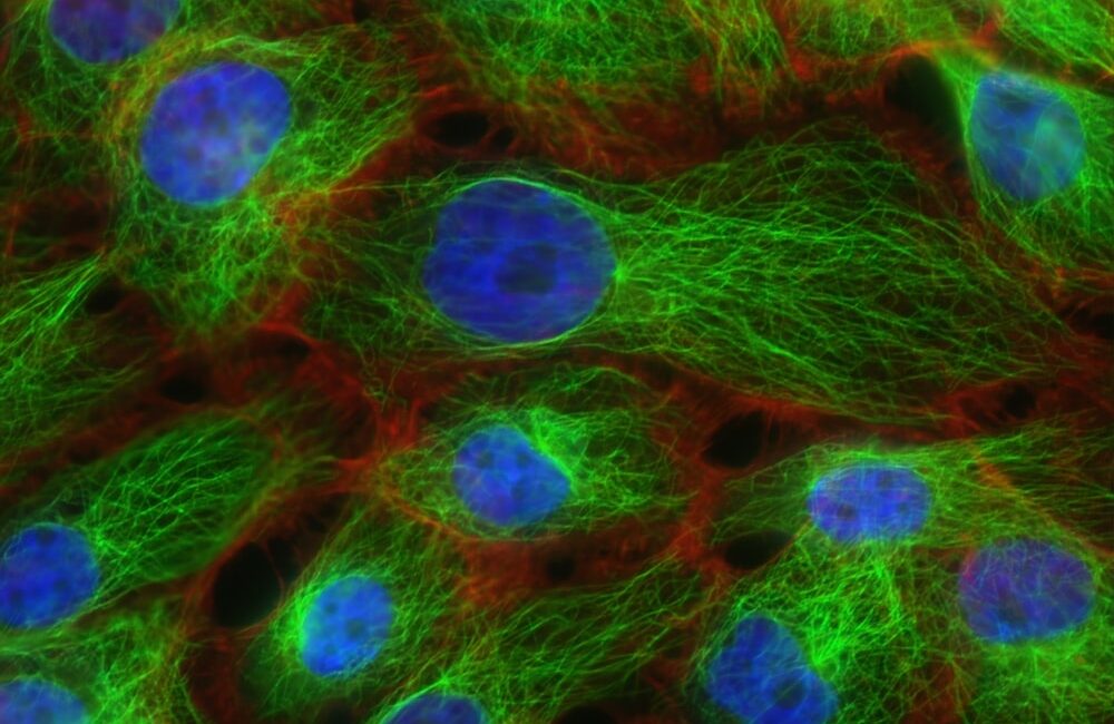甲狀腺結節：正確的識别與診斷