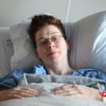 骨裂是如何發生的?常見骨裂的原因解析 2 photo 1550791871 0bcd47c97881