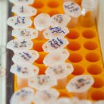 關節保健:保護關節健康的關鍵方法 1 photo 1583912267623 a5a8c1ef7b56