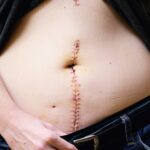 痛風知識普及:了解症狀、診斷和漸進性治療 1 photo 1584125755736 aa6ce644fc09