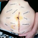 痔瘡症狀及其對身體的影響:早期發現和治療的重要性 7 photo 1551224377 fb123ee4a4d6