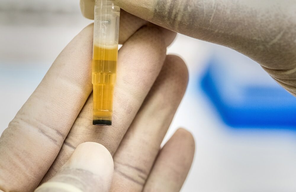 預防骨裂:關鍵提示及方法 2 預防骨裂:關鍵提示及方法