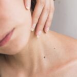 photo 1561228987 8e7379dde477